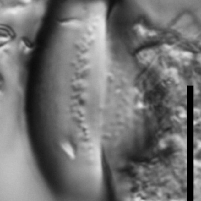 Chaetoceros muelleri LM4