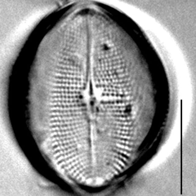 C Pediculus 11