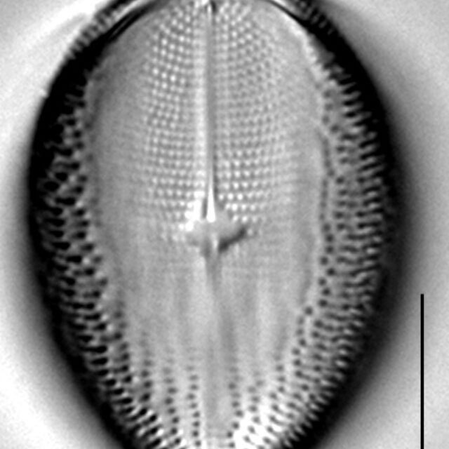 C Pediculus 14