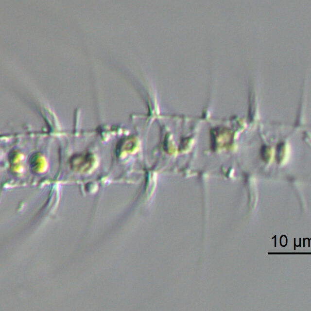 Chaetoceros constrictus LM3