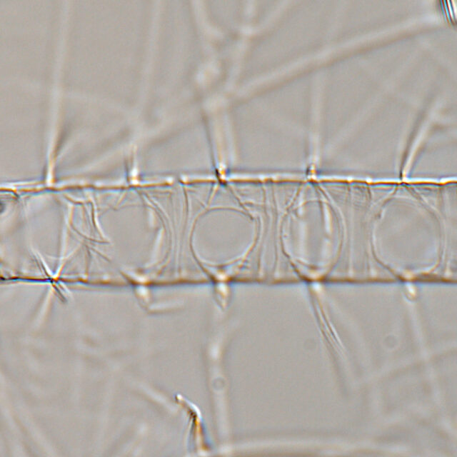 Chaetoceros constrictus LM4