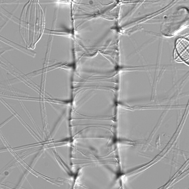 Chaetoceros constrictus LM5 copy