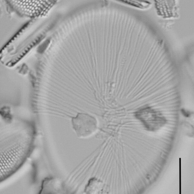 Cocconeis coreana auxospore