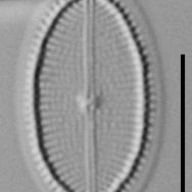 Cocconeis Neodiminuta Lm02