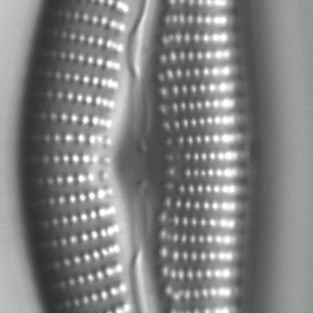 Diatom  Photos18317