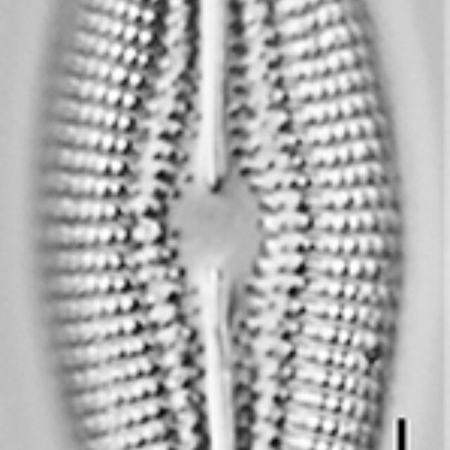 Diploneis abscondita LM1