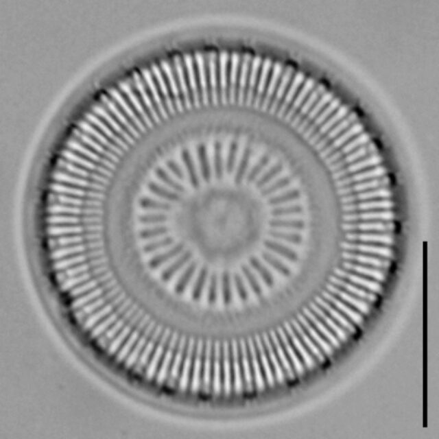 Discostella asterocostata LM4