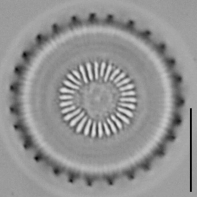 Discostella asterocostata LM6