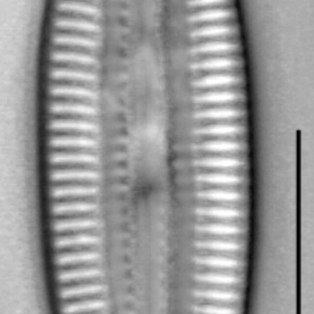 Diploneis submarginestriata LM3