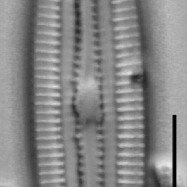 Diploneis submarginestriata LM5