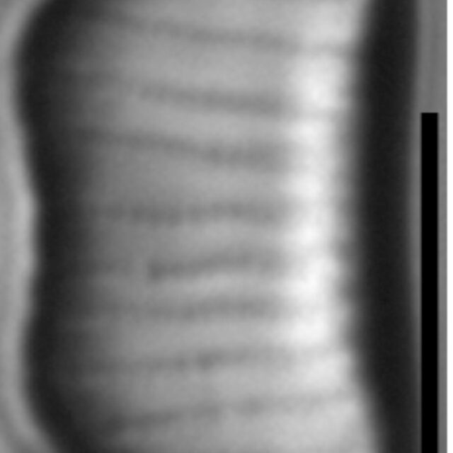 Eunotia kociolekii LM3