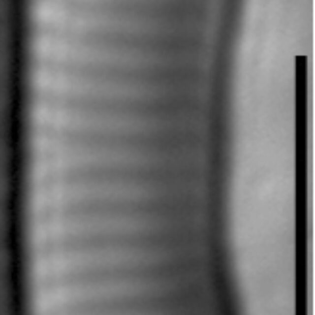 Eunotia orthohedra LM1