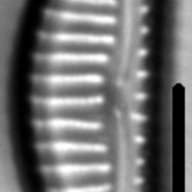 Encyonema procerum LM4