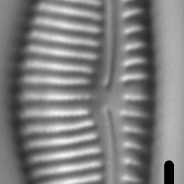 Encyonema Silesiacum LM6