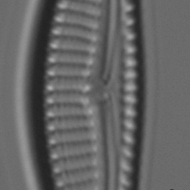 Encyonema silesiacum var elegans LM3