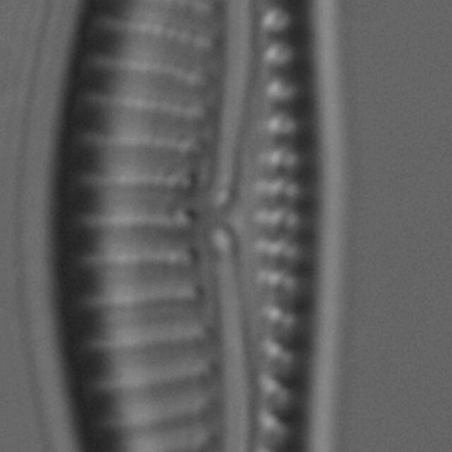 Encyonema silesiacum var elegans LM4