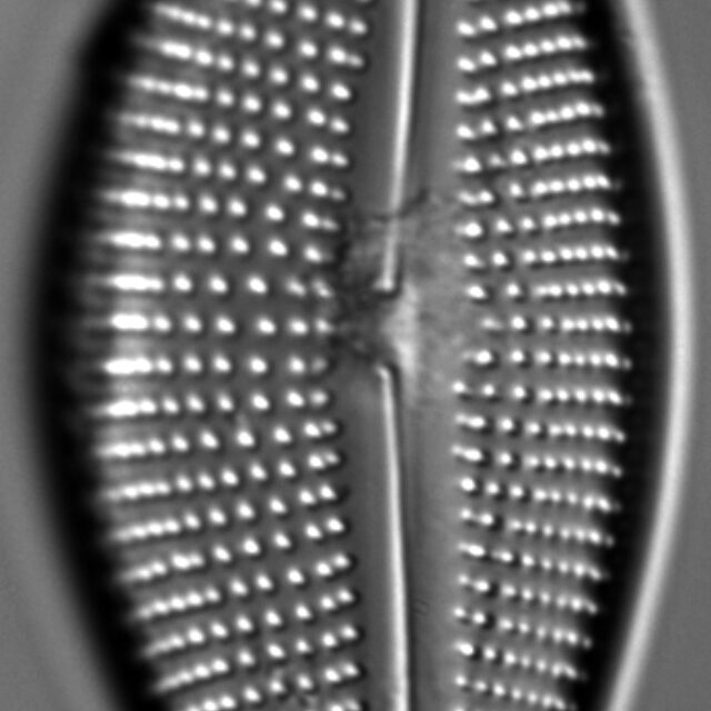 Encyonema triangulum LM2