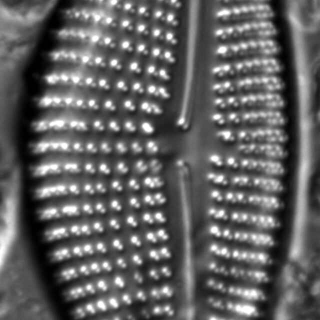 Encyonema triangulum LM5