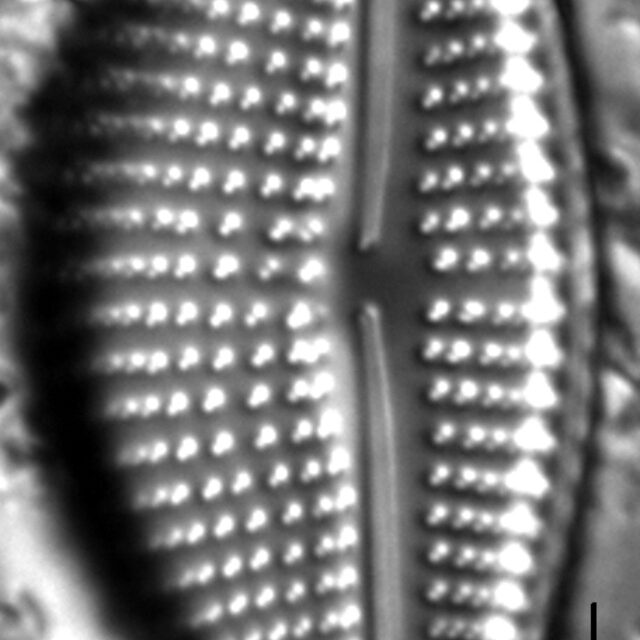 Encyonema triangulum LM7