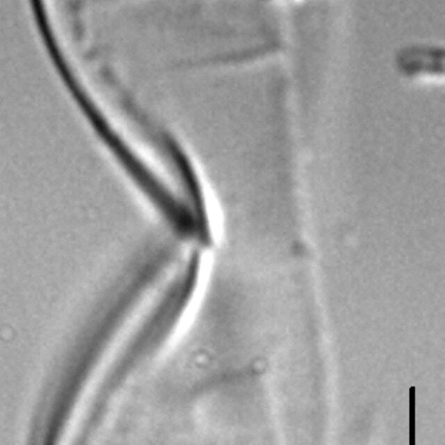 Entomoneis punctulata LM6