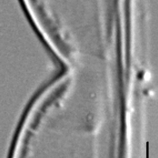 Entomoneis punctulata LM5