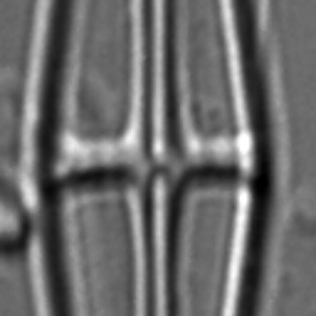 Envekadea pachycephala LM3