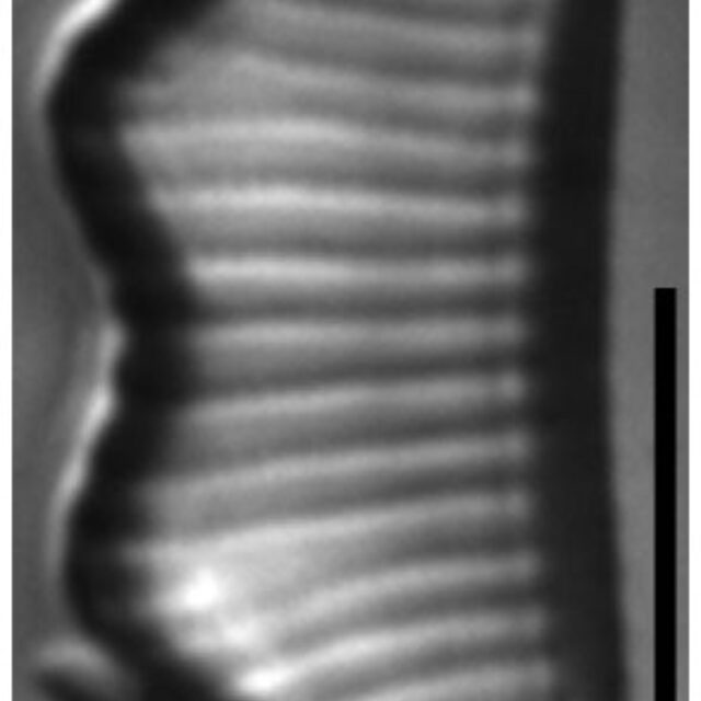 Eunotia subherkiniensis LM7