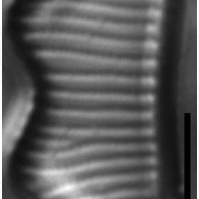 Eunotia subherkiniensis LM6