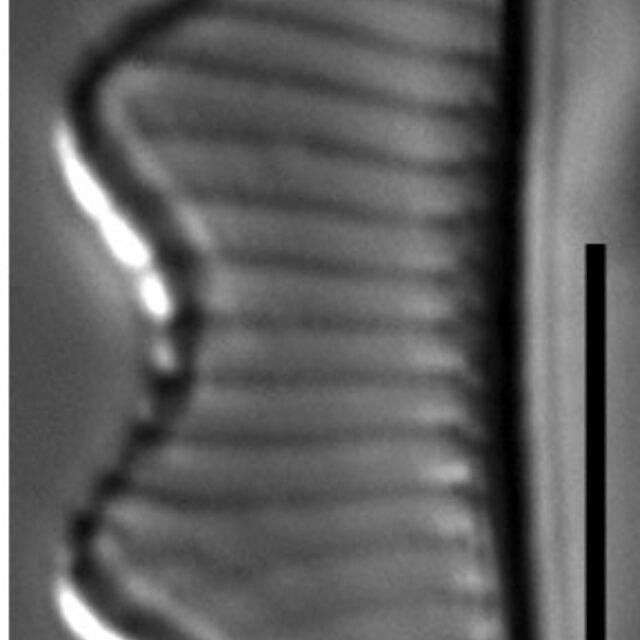 Eunotia subherkiniensis LM8