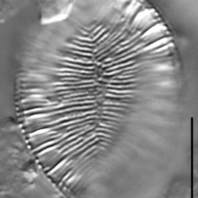 Surirella iowensis LM1