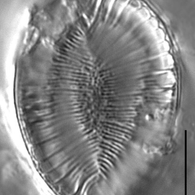 Surirella iowensis LM2