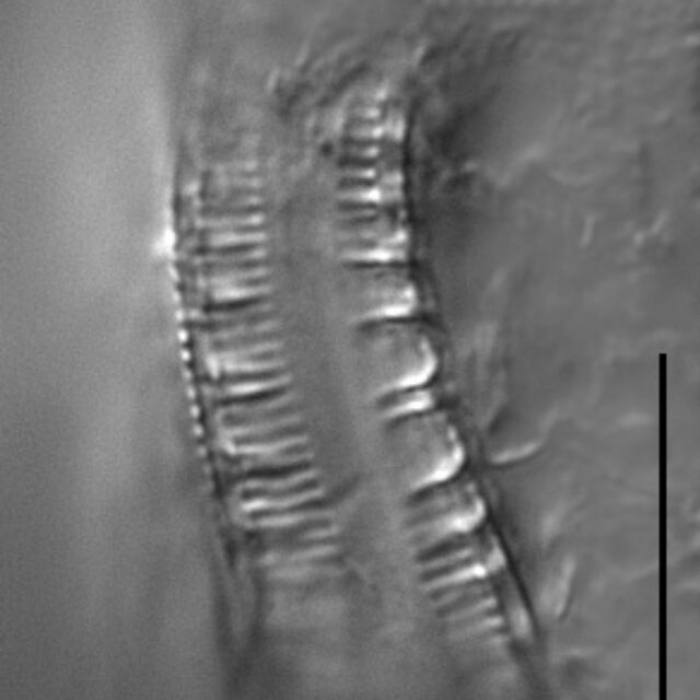 Surirella iowensis LM5