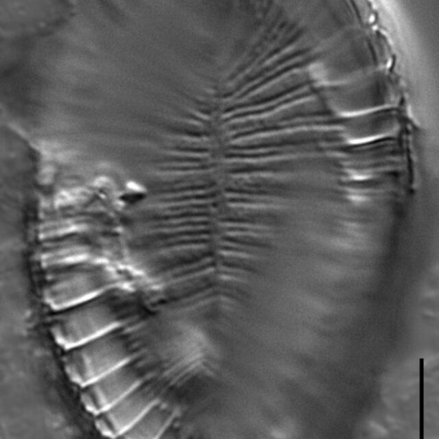 Surirella iowensis LM6