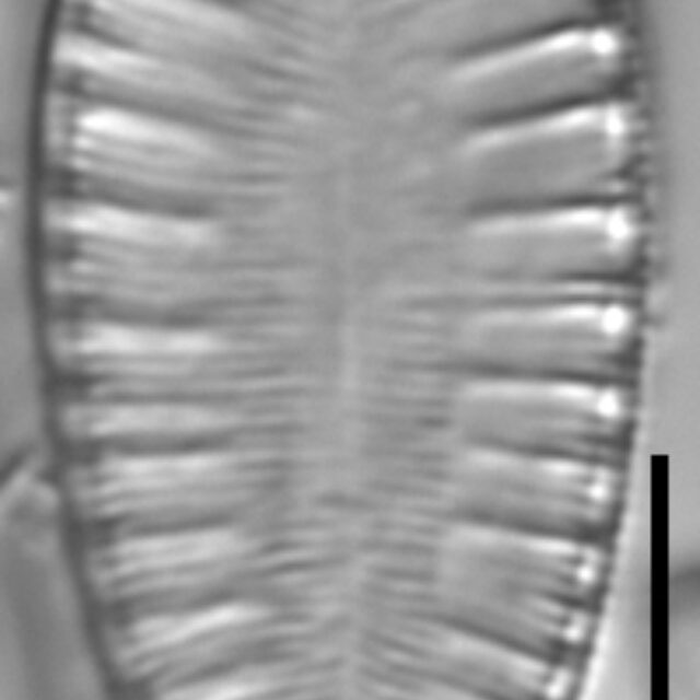 Surirella lacrimula LM6