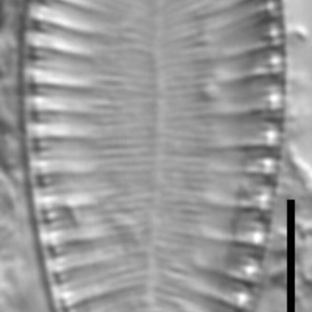 Surirella lacrimula LM5