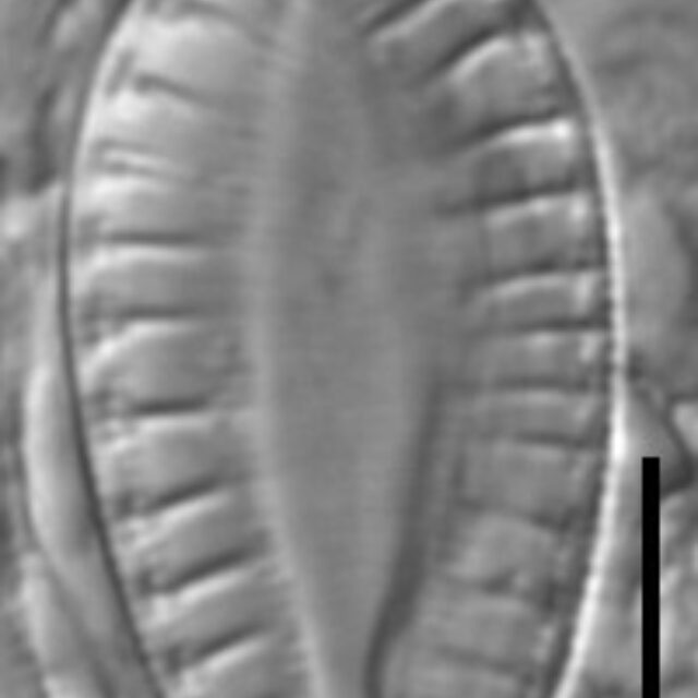 Surirella lacrimula LM7