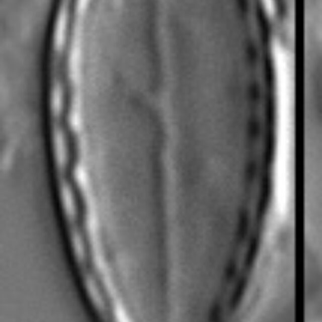 Surirella stalagma LM1