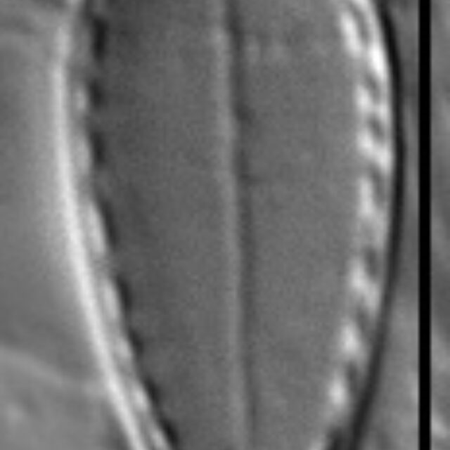 Surirella stalagma LM5