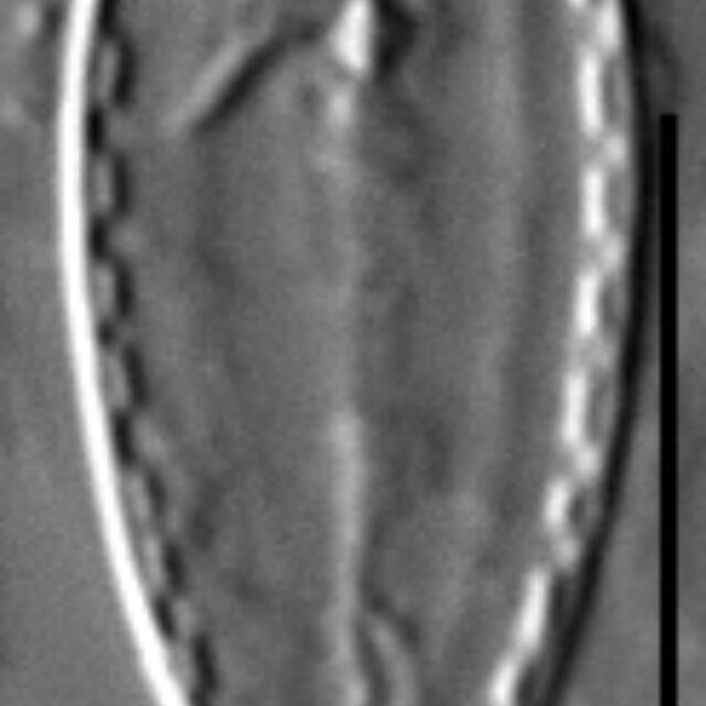 Surirella stalagma LM7