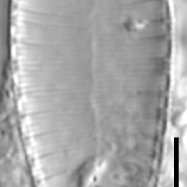 Suirella lacrimula LM2