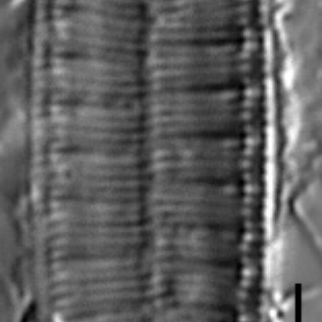 Surirella angusta LM6