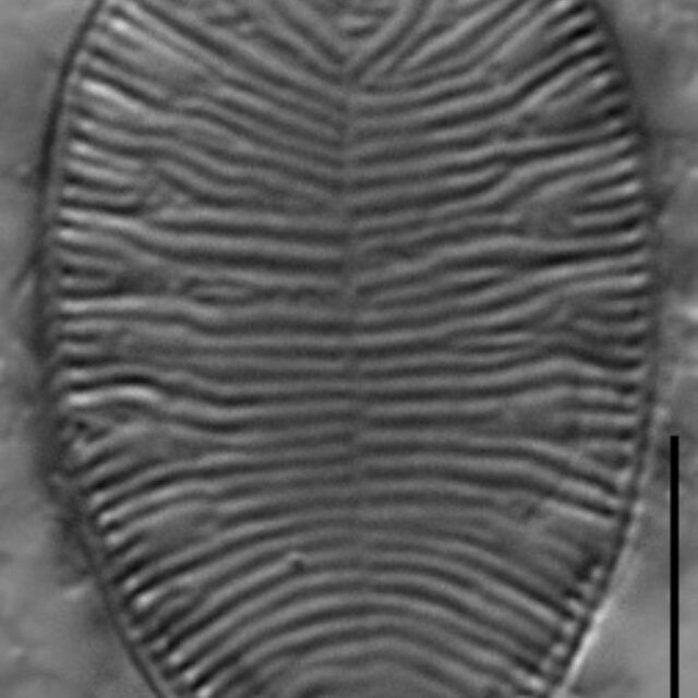 Gc112761A Brebissonii 3