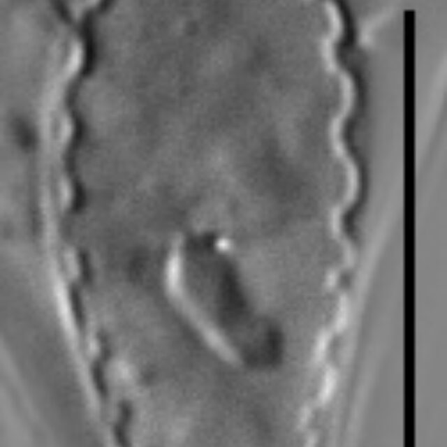 Surirella atomus LM1