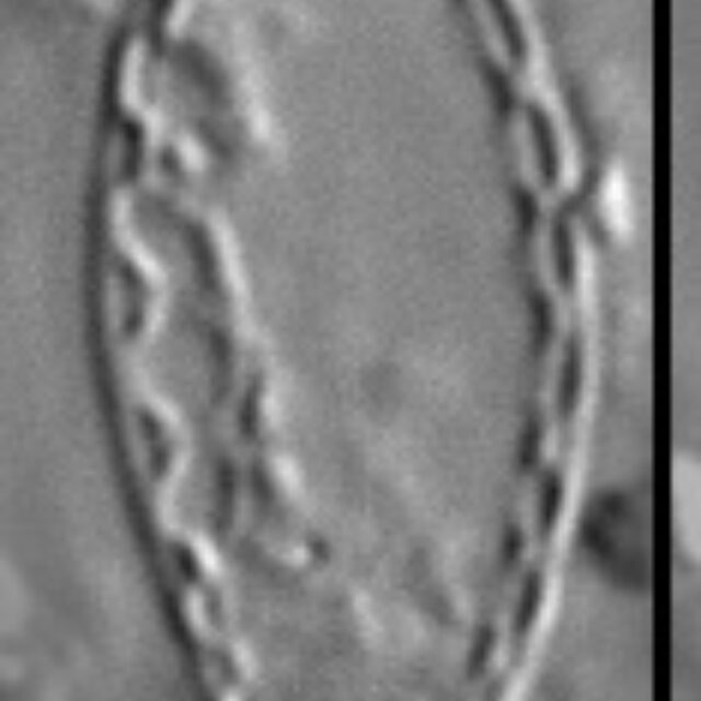 Surirella atomus LM4