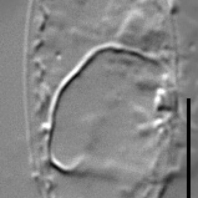 Surirella atomus LM5