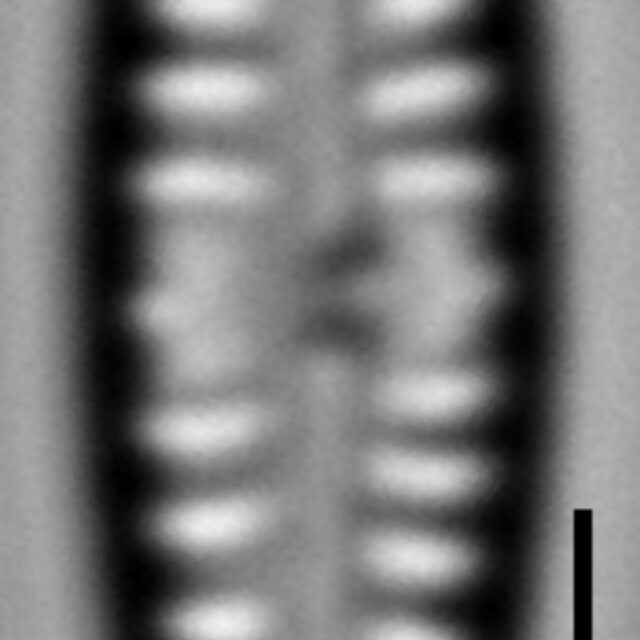 Gomphonema superiorense LM6