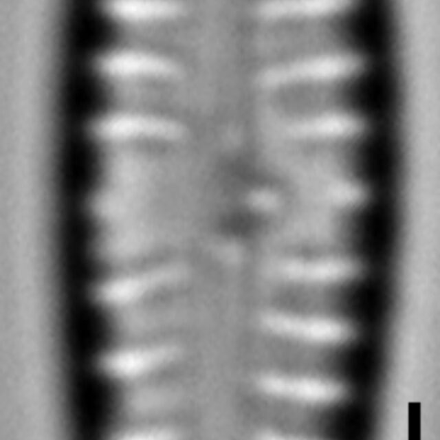 Gomphonema superiorense LM2