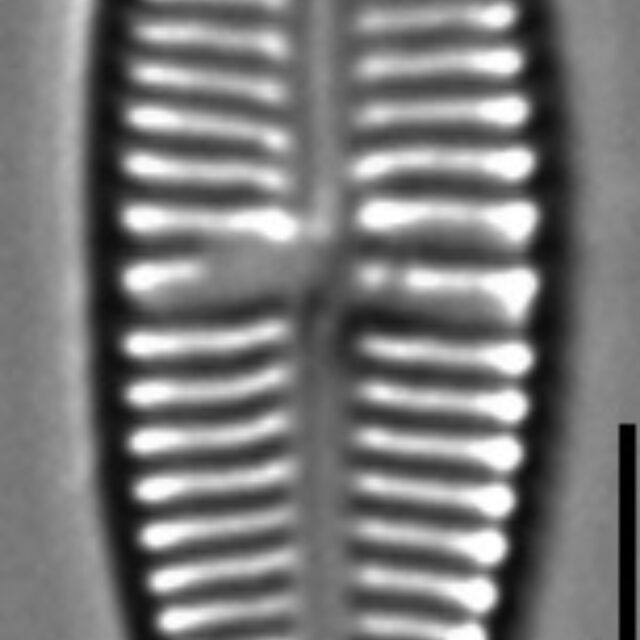 Gomphonema Lagenula LM4