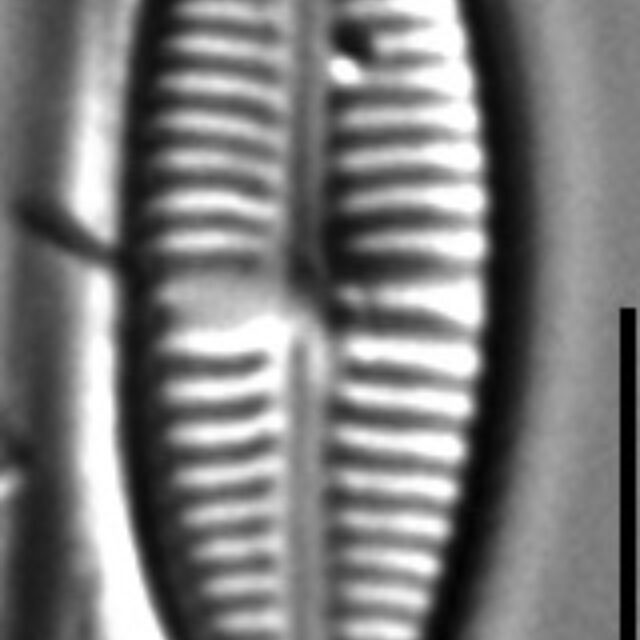 Gomphonema Lagenula LM7