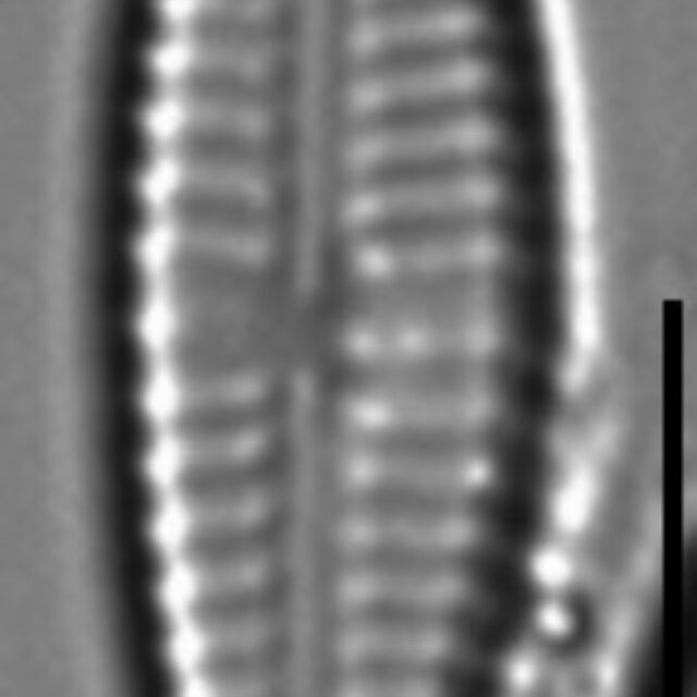 Gomphonema Lagenula LM6